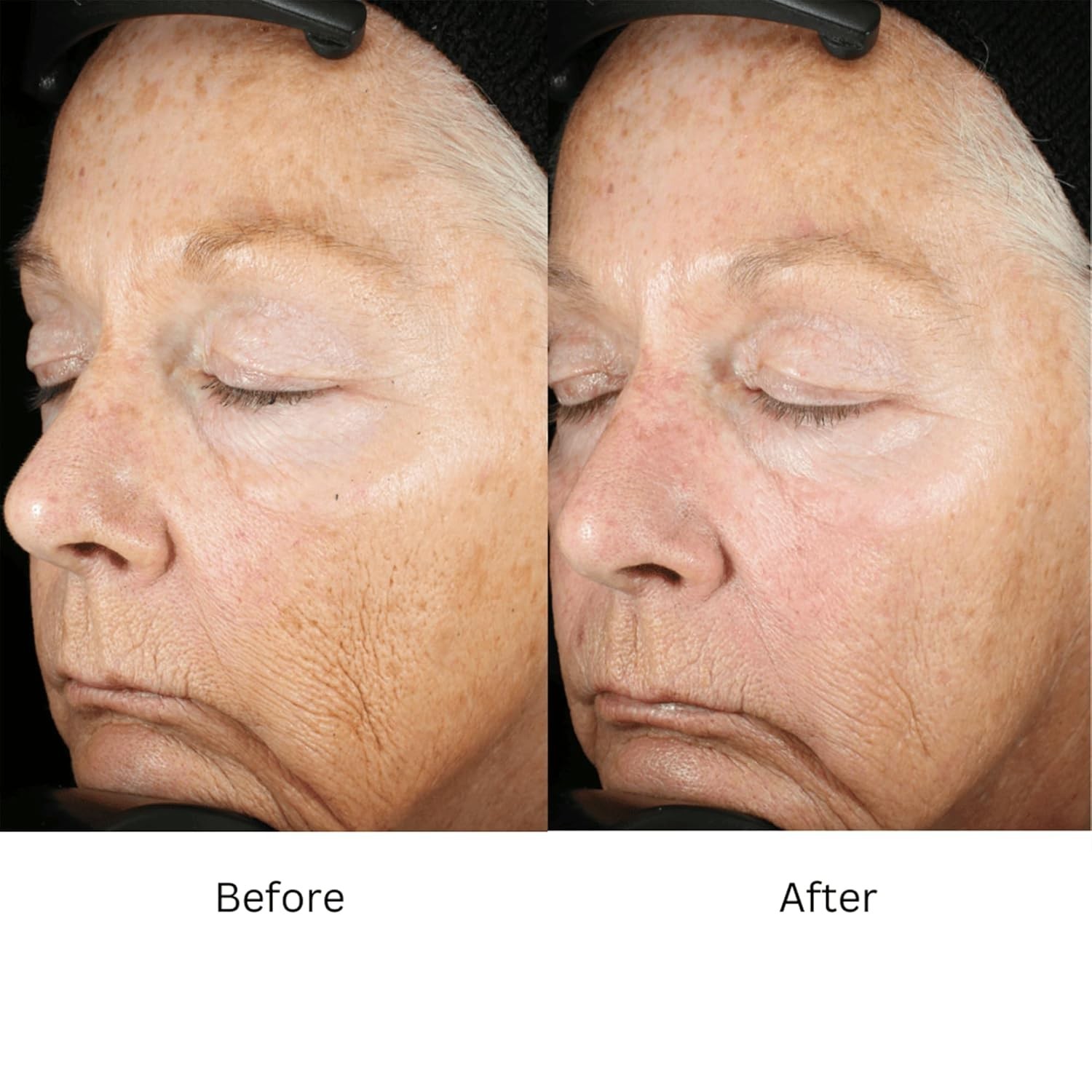 ZO Skin Health Wrinkle + Texture Repair 50ml /1.7 fl oz Anti-Aging New in Box