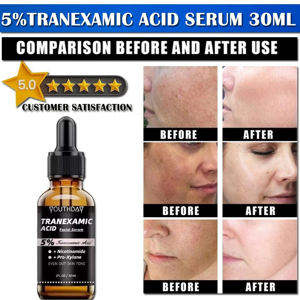 5% Tranexamic Acid Serum With Niacinamide, Kojic Acid, Arbutin, Reduce Dark Spot