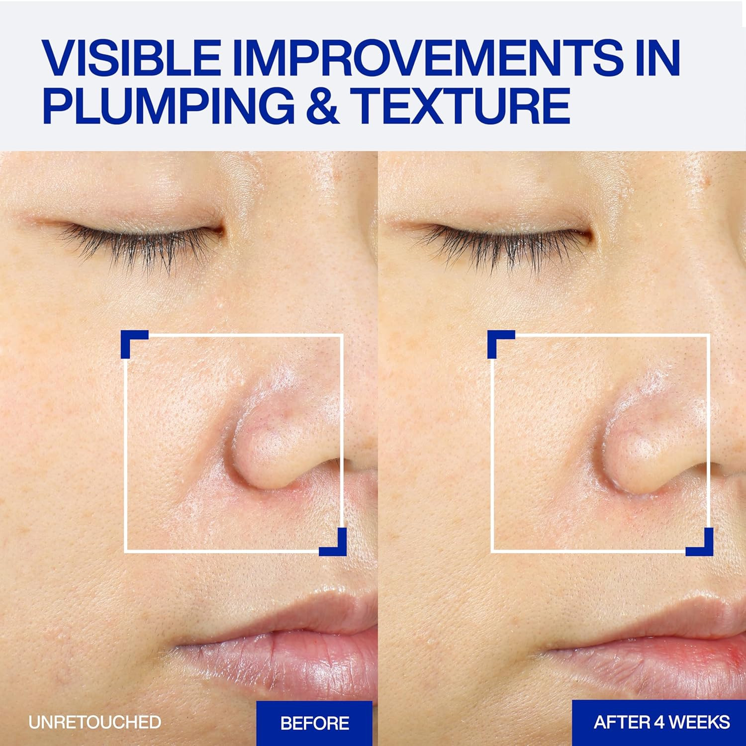 IOPE XMD Stem III Clinical Recovery Serum – Professional PDRN Treatment-Level Re