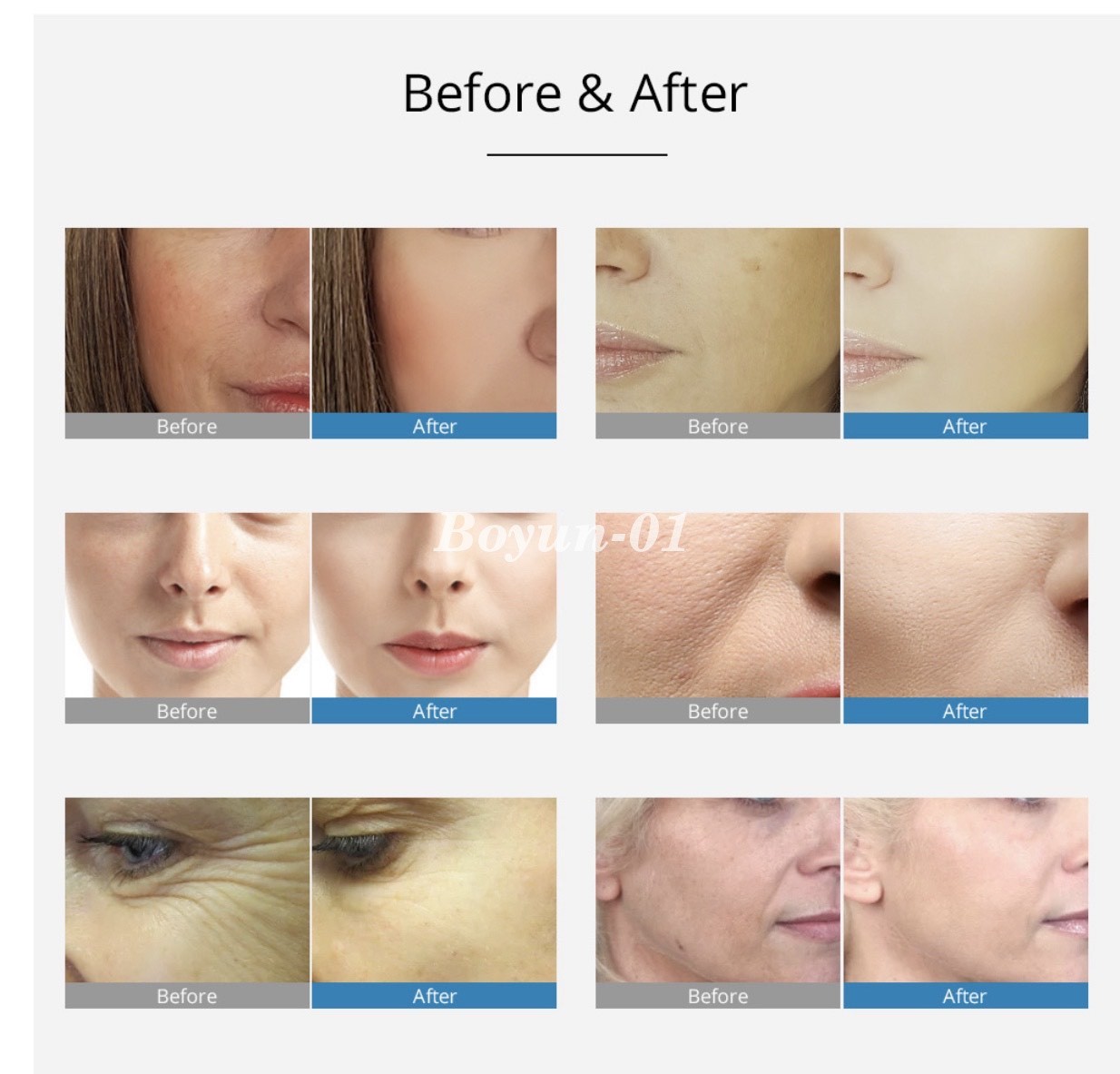 EMS RF No Needle Mesotherapy Gun Skin Care Machine for Face Lifting Anti Aging