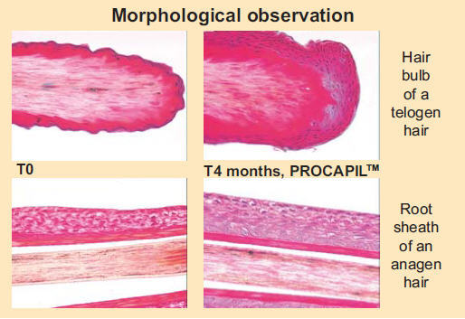 HAIR GROWTH PEPTIDE BIOTINYL-GHK PROCAPIL