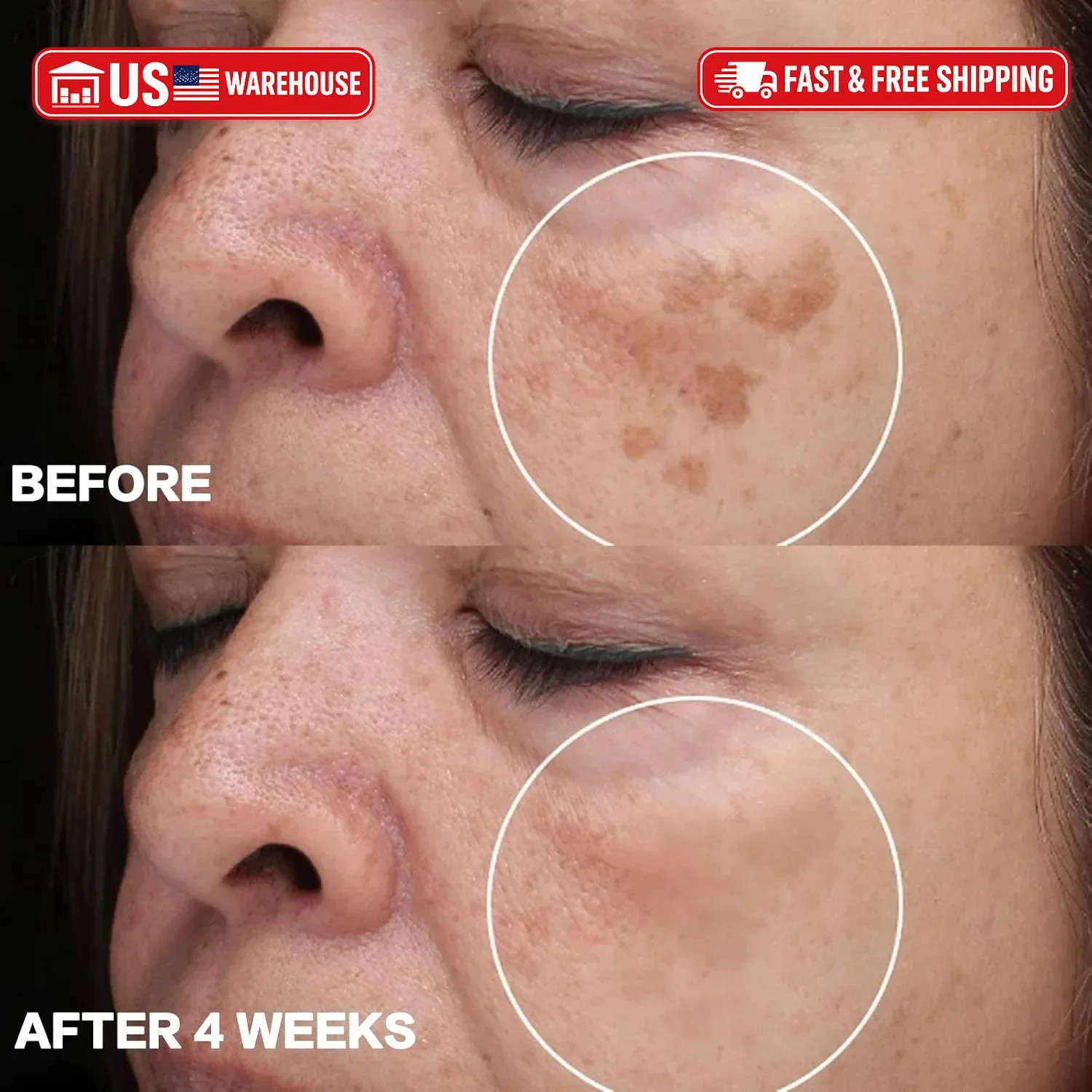 CITYGOO Dark Spot Remover for Face: Dark Spot Corrector Cream – Enriching Skin C