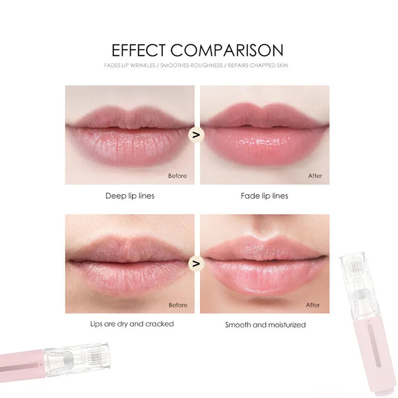 Women Facial Lip Derma Roller Professional Skincare Tools,Titanium Micro Needles