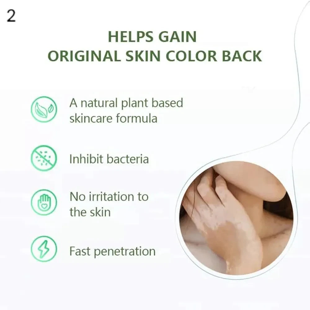 Vitiligo Gel 35ml – Clears White Spots, Evens Tone & Fades Scars