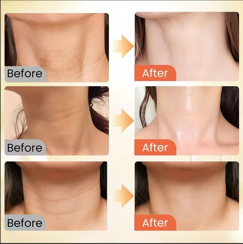 Smooth and Tighten Neck Skin with AH-8 Firming Cream & Massage Roller 4.2 Fl Oz