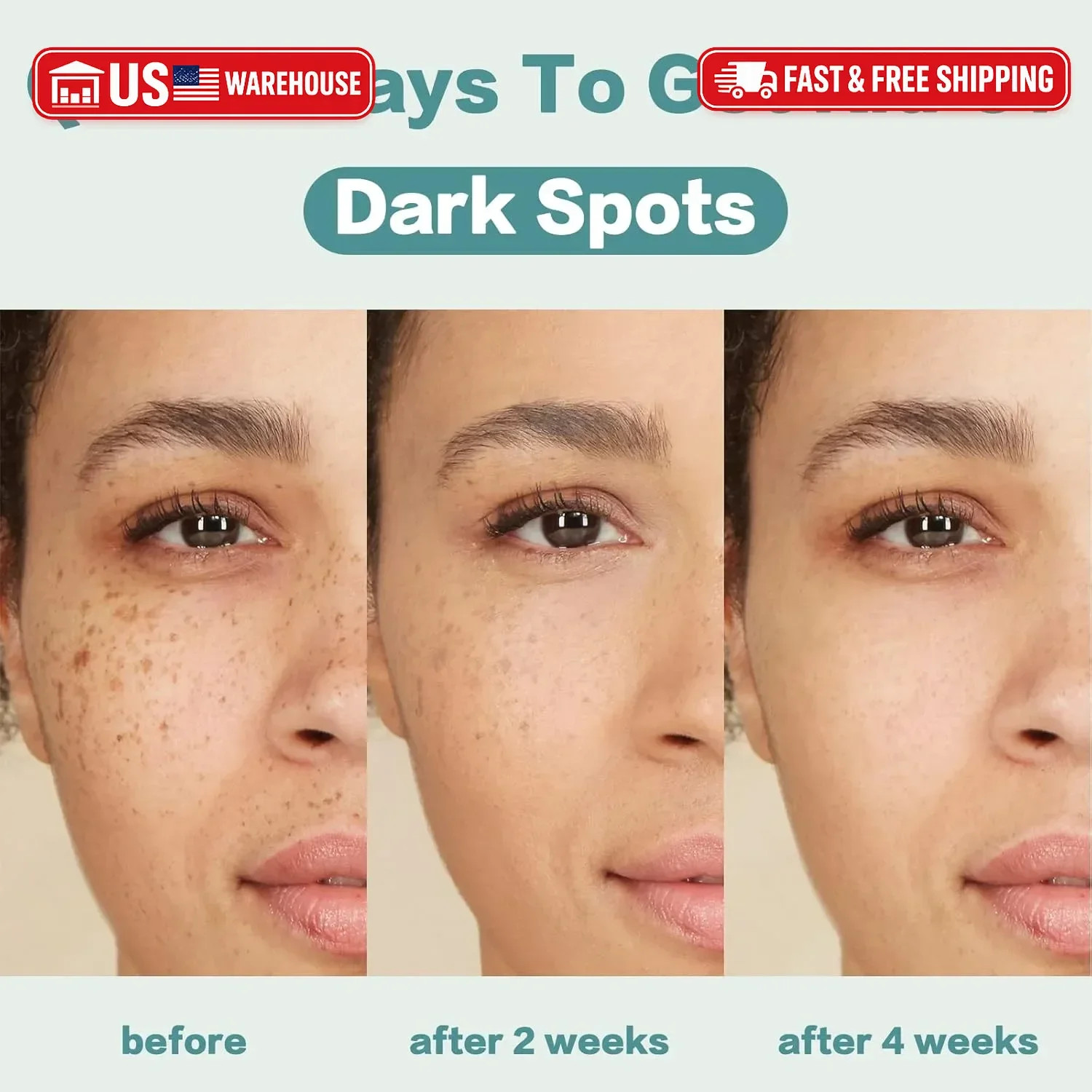 CITYGOO Dark Spot Remover for Face: Dark Spot Corrector Cream – Enriching Skin C