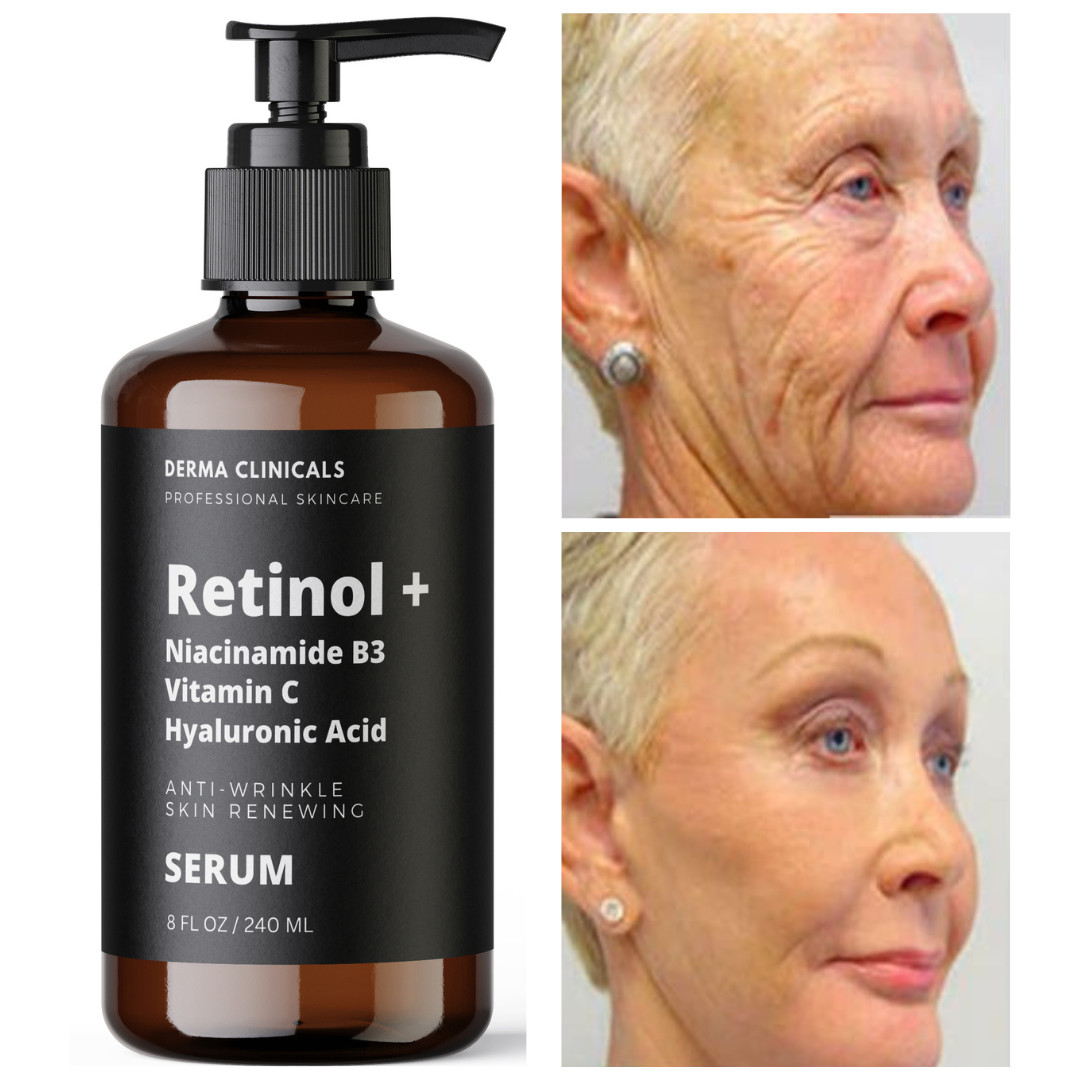8oz – Retinol, Niacinamide, Vitamin C, Hyaluronic Acid, AntiAging Wrinkle SERUM