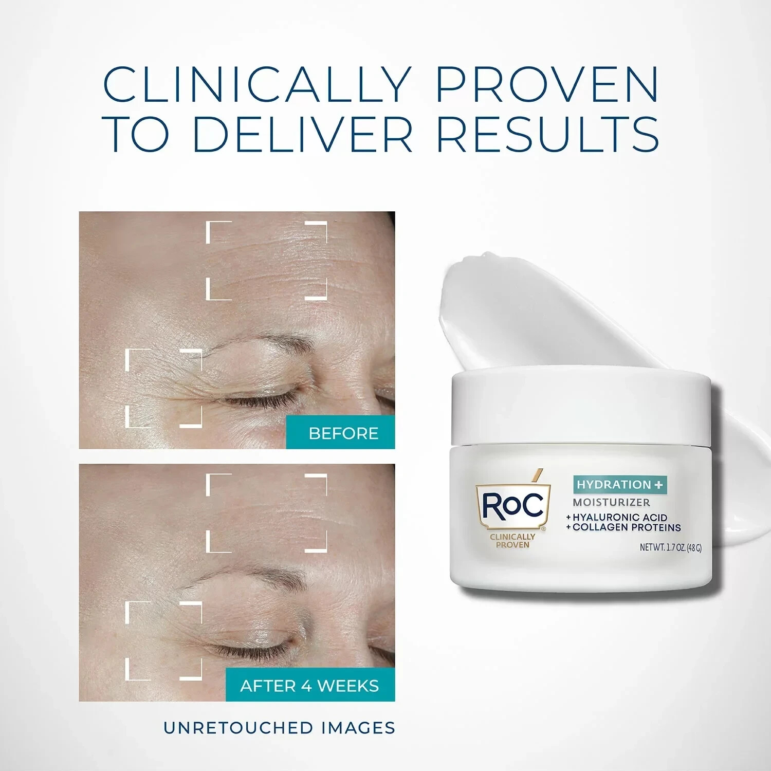 ROC Hydration Plus Moisturizer & Hydration Plus Serum Reduces Dry Skin Symptoms