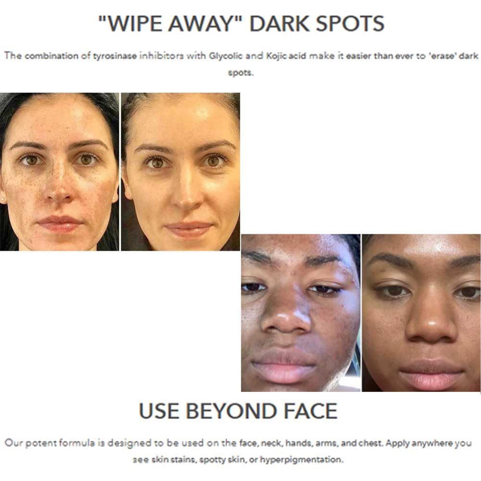New Miami Miami MD MD Dark Spot Corrector for Face & Hands 30 mL