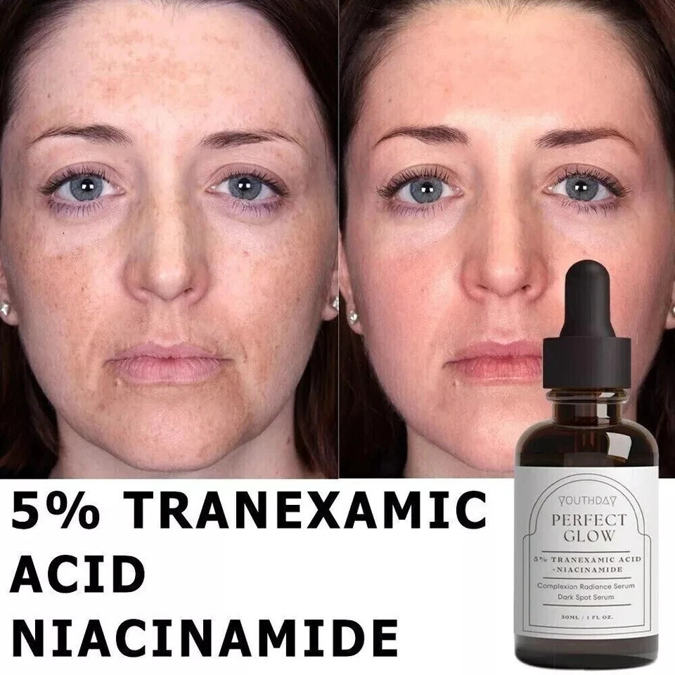 100% Tranexamic Acid Serum 1 fl oz/30ml USA NEW NEW NEW