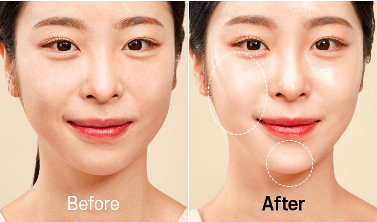 PLLA (10,000ppm) + (15%) PDRN & Glutathione (liposome) Cell Regation Ampoule