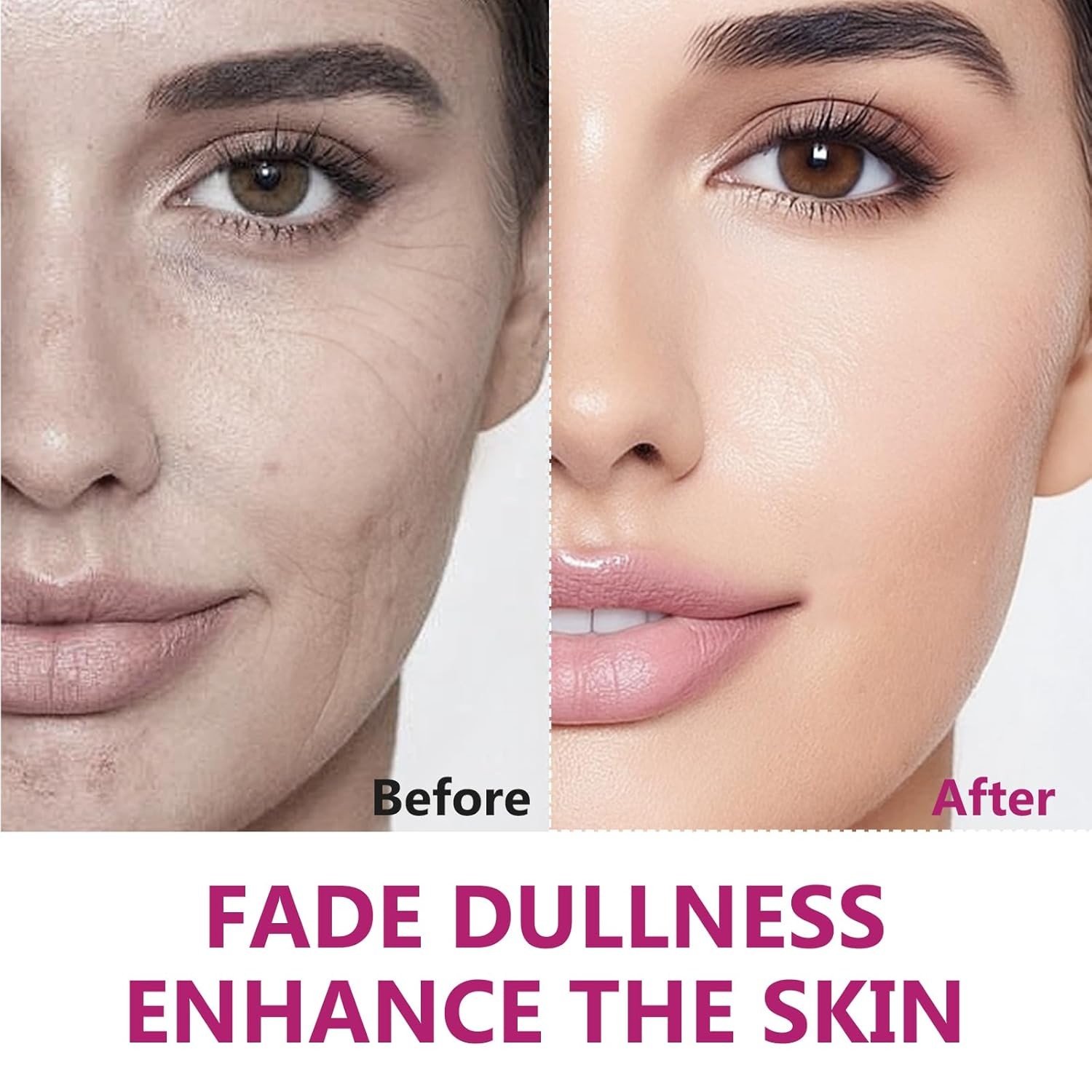 Arbutin 8% & Tranexamic Acid 5% Cream, Help Fade Dark Spots, Freckles, Blemishes