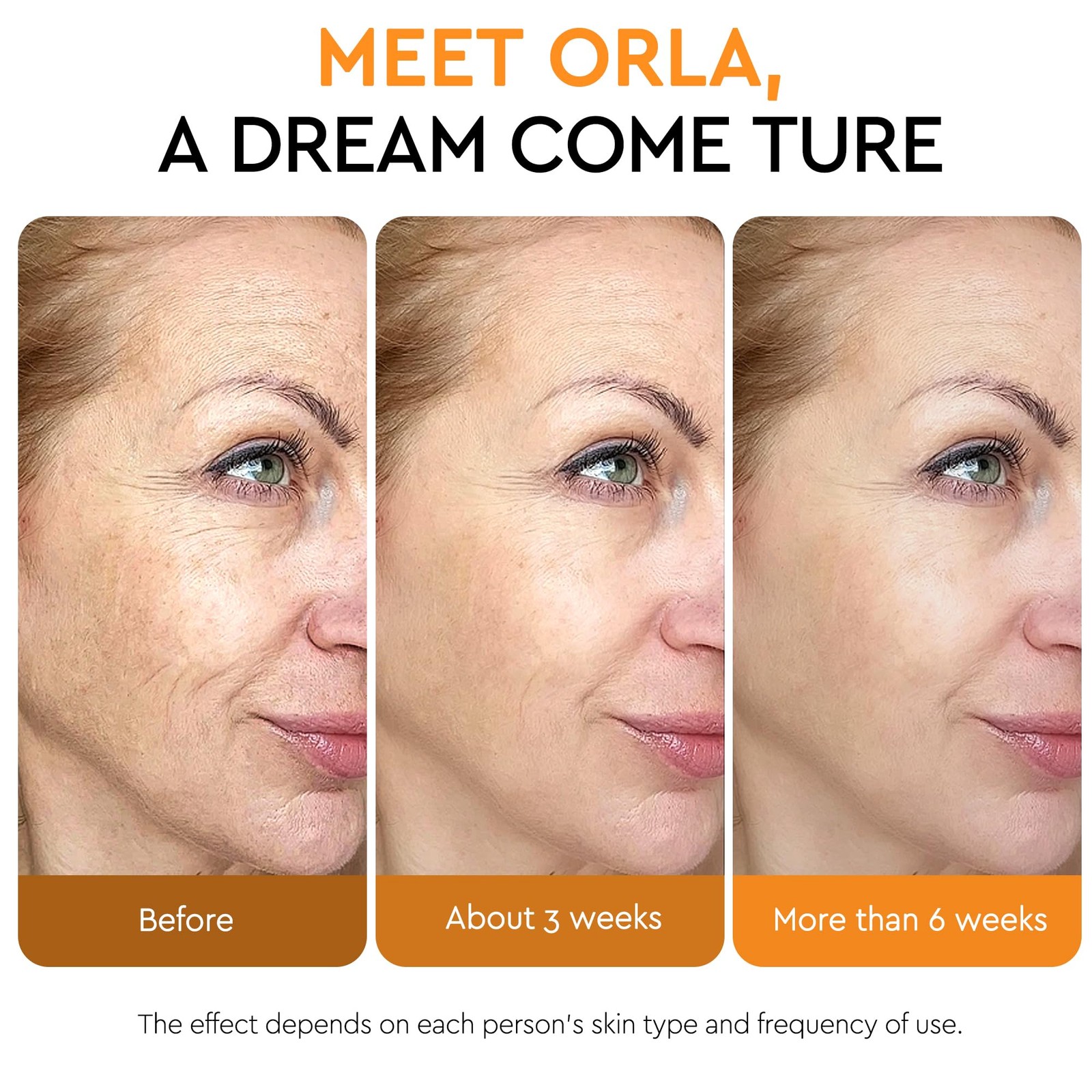 Super Vitamin C Serum For Women Over 70,Vitamin C Face Serum For Women Anti A…