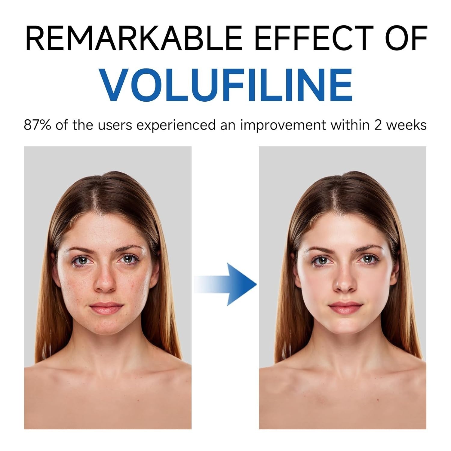 Volufiline Serum 10ml Anemarrhena Root Extract Anti-Aging Face Neck Care