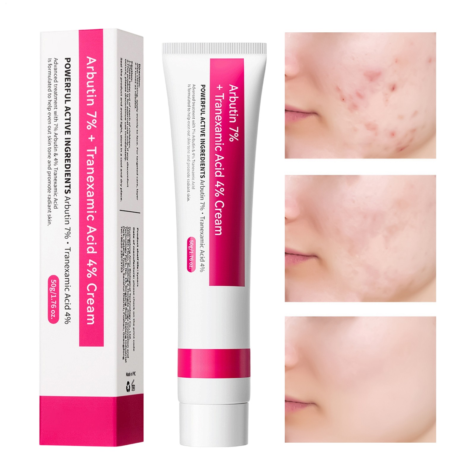 Arbutin 7% + Tranexamic Acid 4% Moisturizer,Dark Spot Corrector facial Moistu…