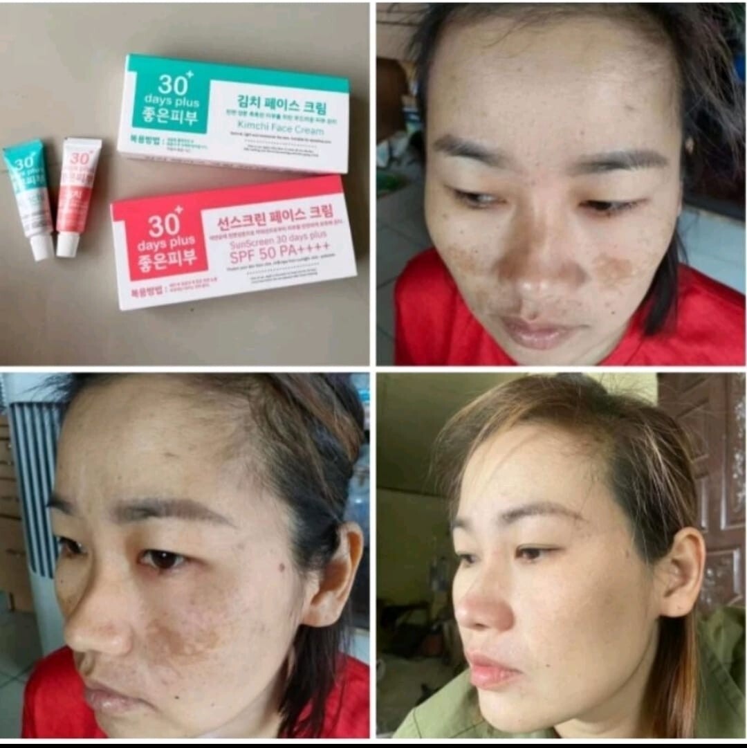 1 SET KIMCHI (EXP: 10/25,01/26) FACECREAM 30 DAYS PLUS + SUN SCREEN SPF50 PA+++