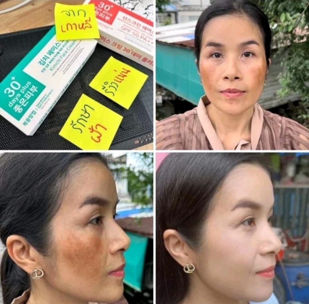 1 SET KIMCHI (EXP: 10/25,01/26) FACECREAM 30 DAYS PLUS + SUN SCREEN SPF50 PA+++