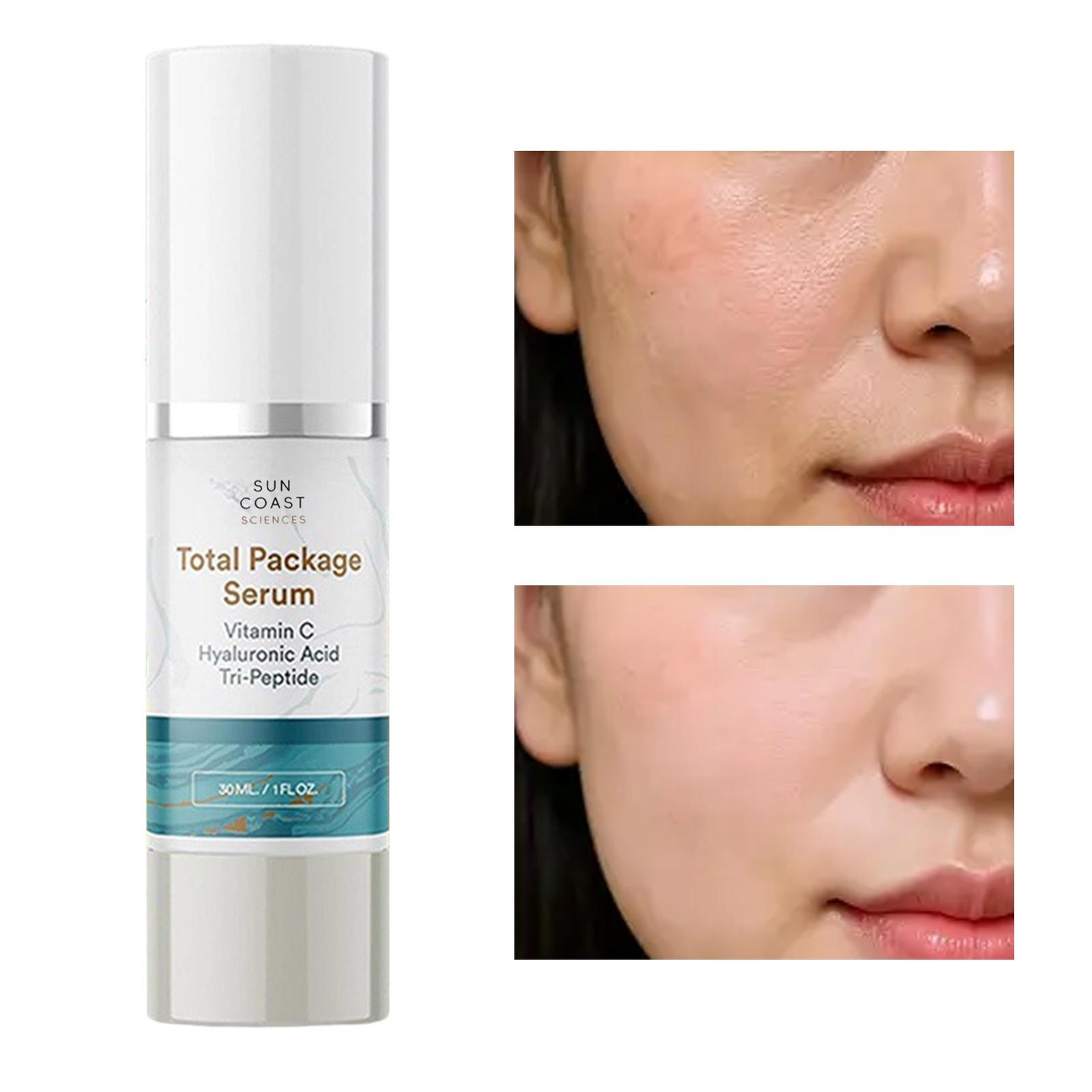 3- Sun Coast Sciences TOTAL PACKAGE SERUM 1oz Vitamin C Hyaluronic Acid