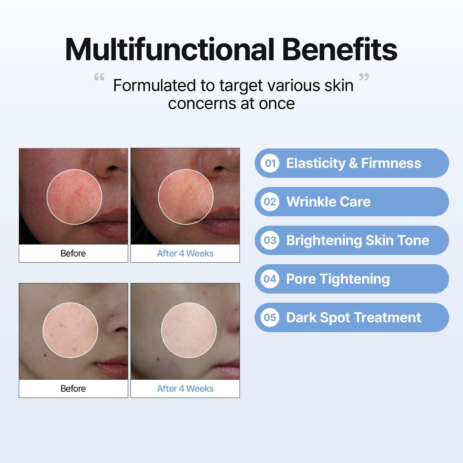 Retinal Skin Booster Serum | Retinaldehyde, Niacinamide Anti-Aging Serum – K-Bea