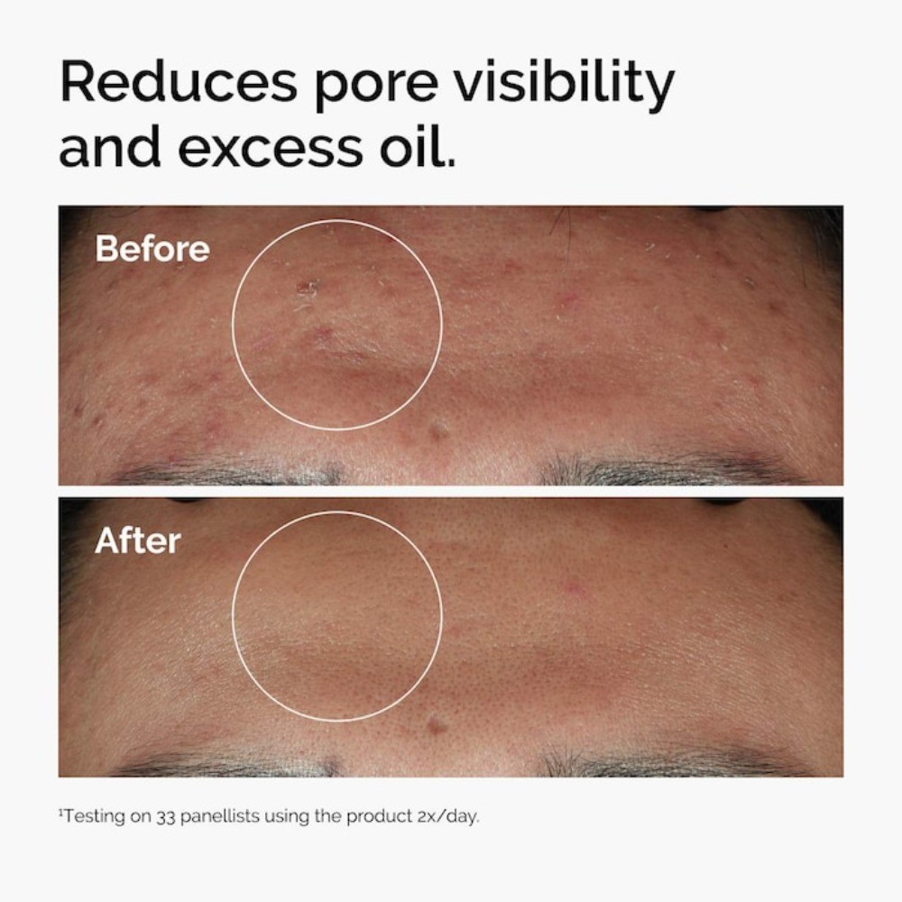 The Ordinary Authentic Niacinamide 10% + Zinc 1% Serum 2 Sizes