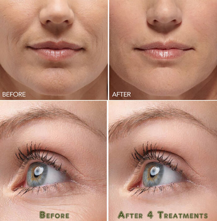 Hyaluronic Acid Gel Cream – Anti-Aging Wrinkle Face & Eye (HA) Serum Moisturizer