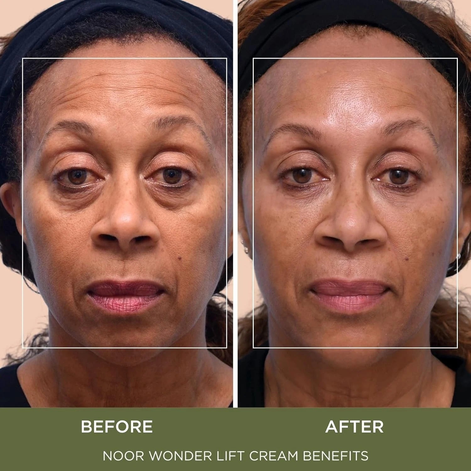 Noor Wonder Lift Cream For Women Natural Anti-Aging Wrinkle Treatment w/ Syn-Ake