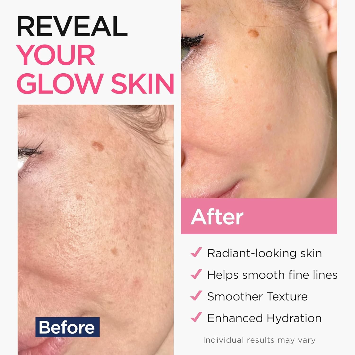 Retinol Serum for Face with Hyaluronic Acid, Vitamin E & Aloe Vera Anti-Aging Se
