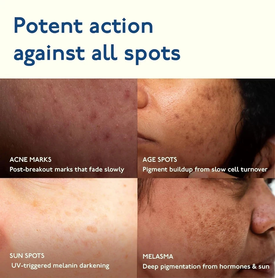 Asaya Advanced Dark Spot Targeting Gel Hyperpigmentation & Scars all skin 15g