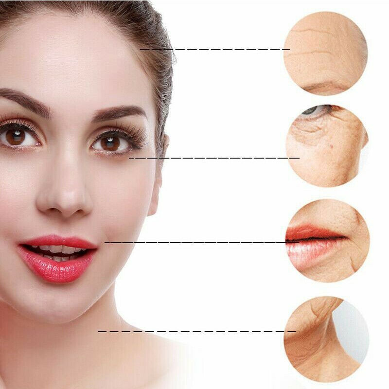 Skin Tightening Anti-aging Beauty Machine for Facial & Neck Skin Wrinkle Removal