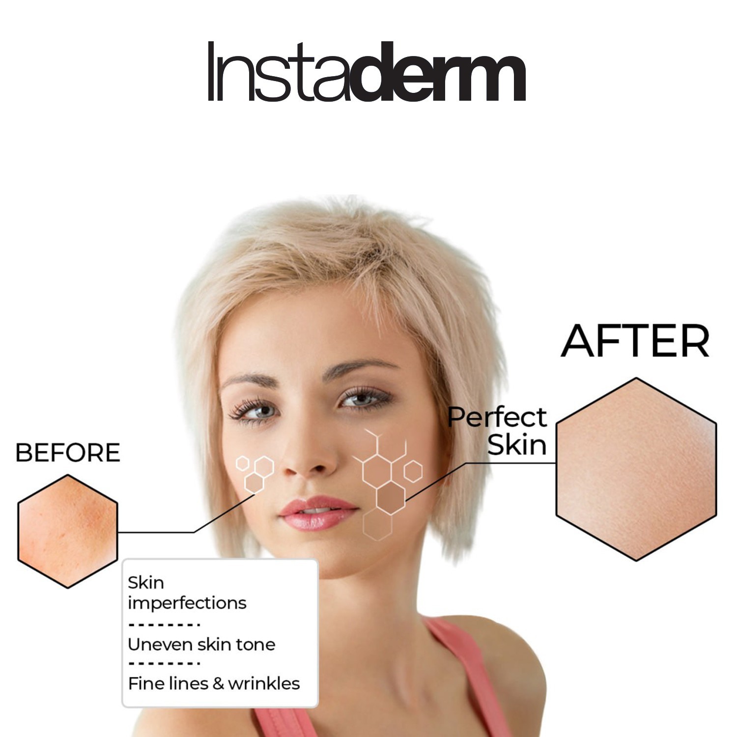 Glycolic Acid 15% – Reduces Fine Lines, Wrinkles, Age Spots, Dark Spots & Scars