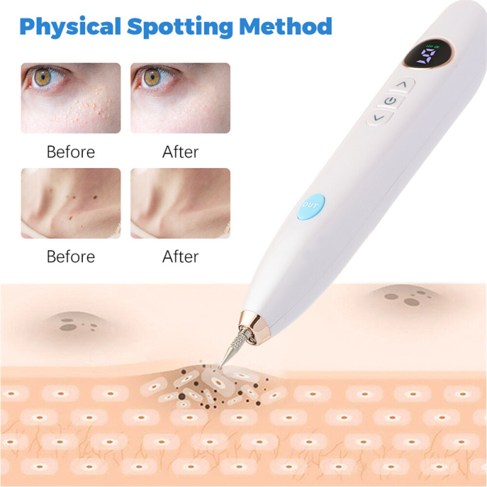 Laser Plasma Pen Tattoo Mole Freckle Spot Mole Removal Skin Tag Wart Remover Pen