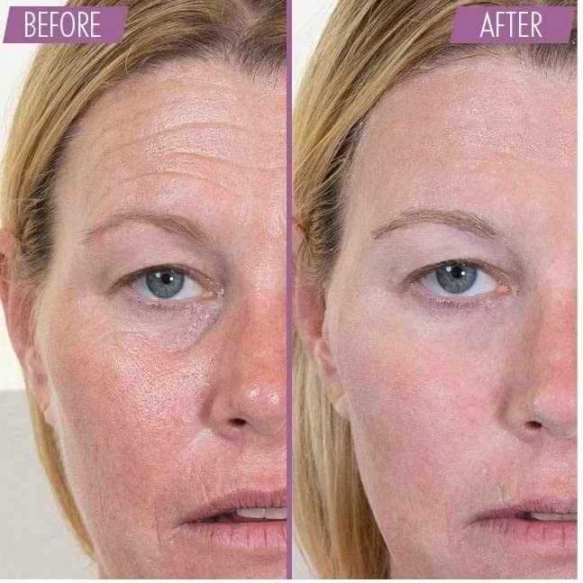7 MINUTE LIFT – with 12 Organic Greek Botanicals – Results in 7 minutes