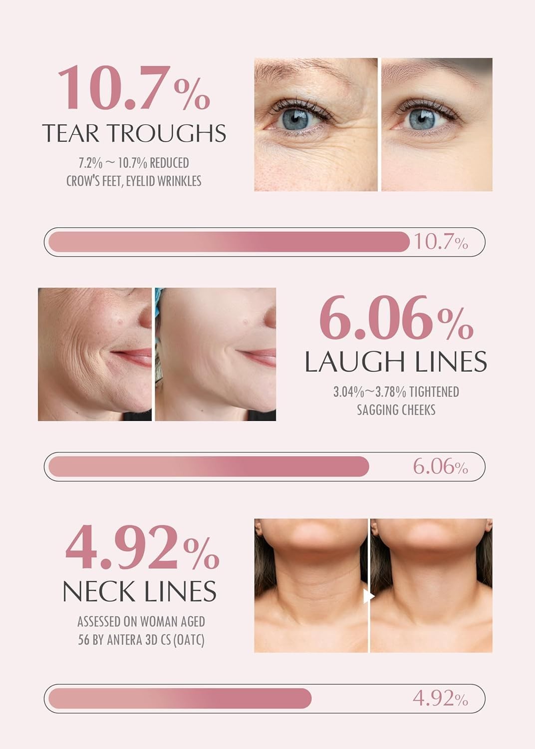 KAHI Wrinkle Bounce Multi Balm Stick | PDRN Collagen Wrinkle Stick | Korean Balm