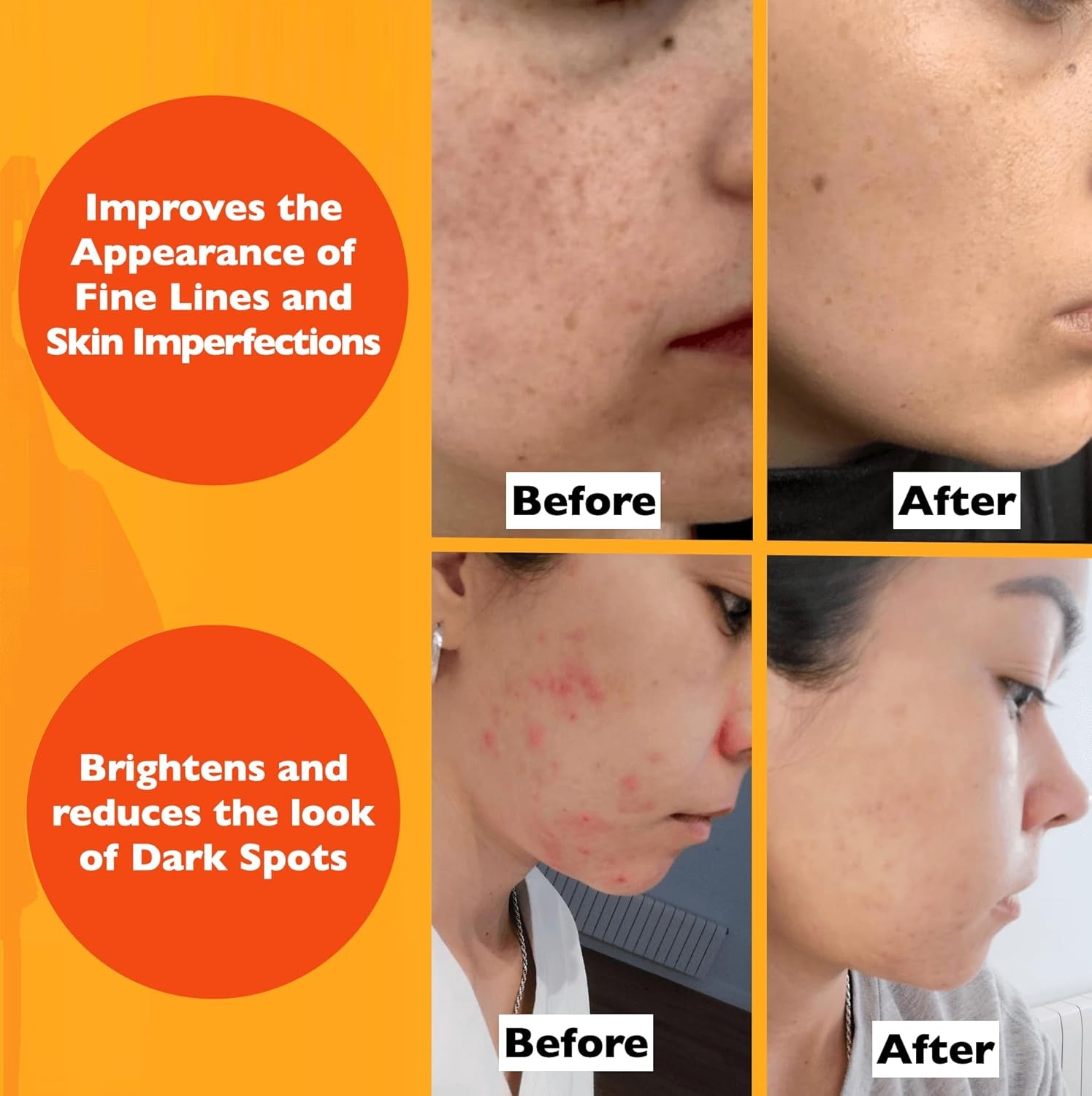 InstaSkincare Vitamin C Facial Serum – 2oz