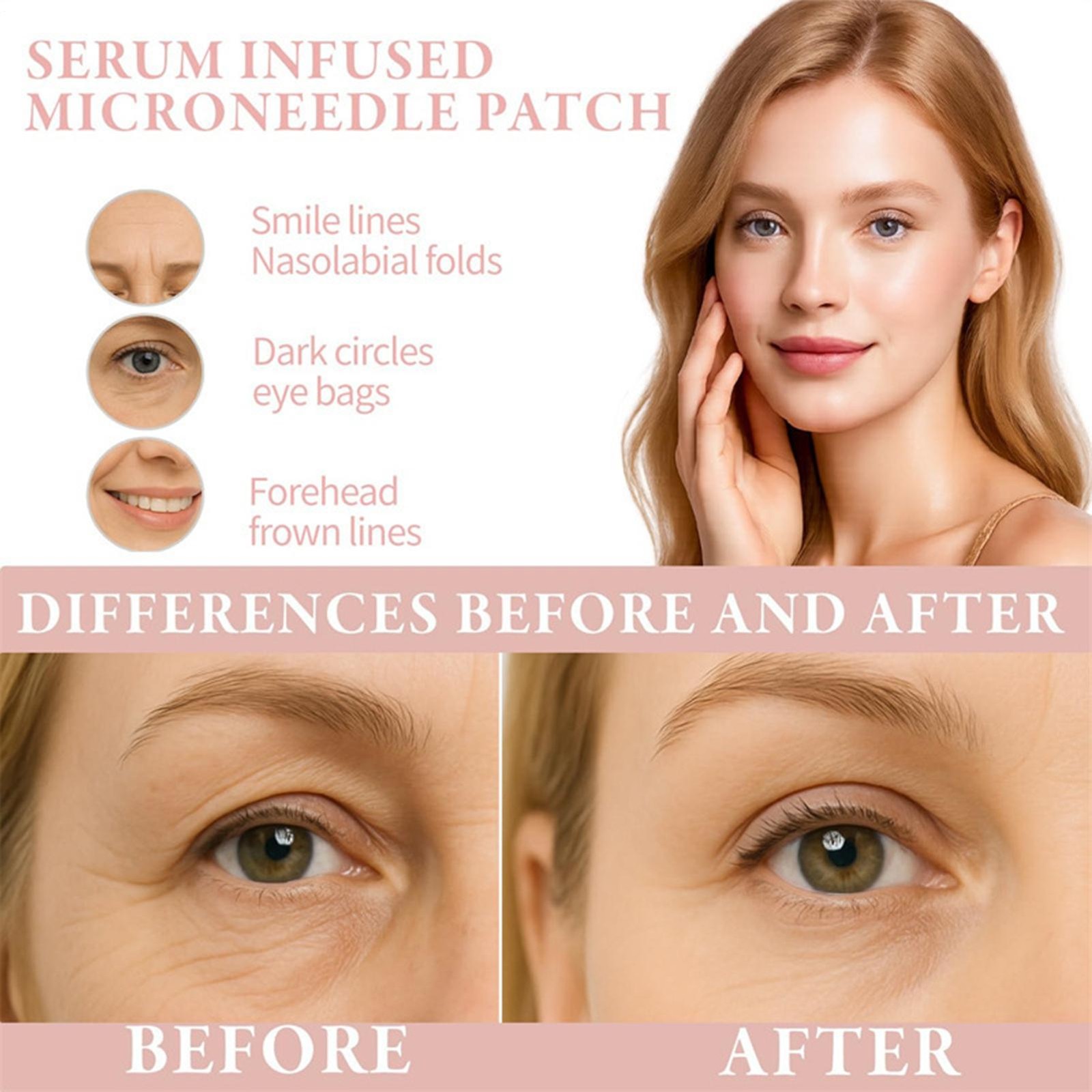 3X Micro-needle Eye Patch Hyaluronic Acid Anti-wrinkle Eye Mask Remove Fine Line
