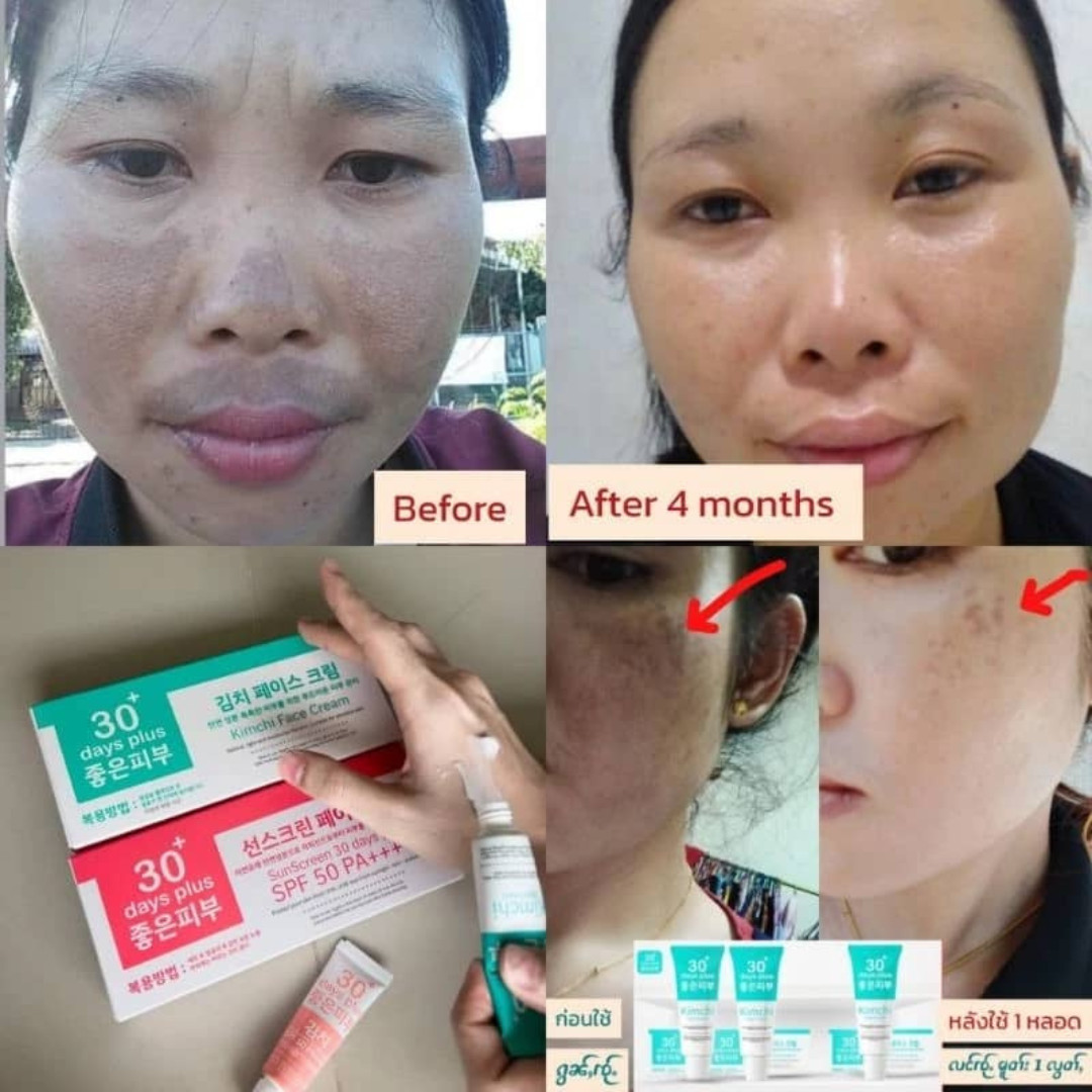 1 SET KIMCHI FACECREAM 30 DAYS PLUS + SUN SCREEN SPF50 PA+++