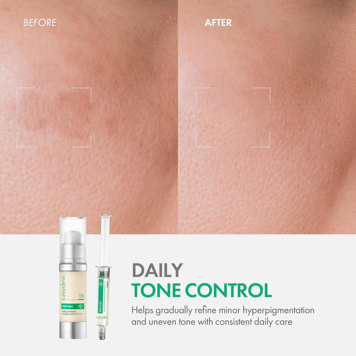 Easydew DW-EGF Melatoning Ampoule 1X – Hydrating Dark Spot Serum with Niacinamid