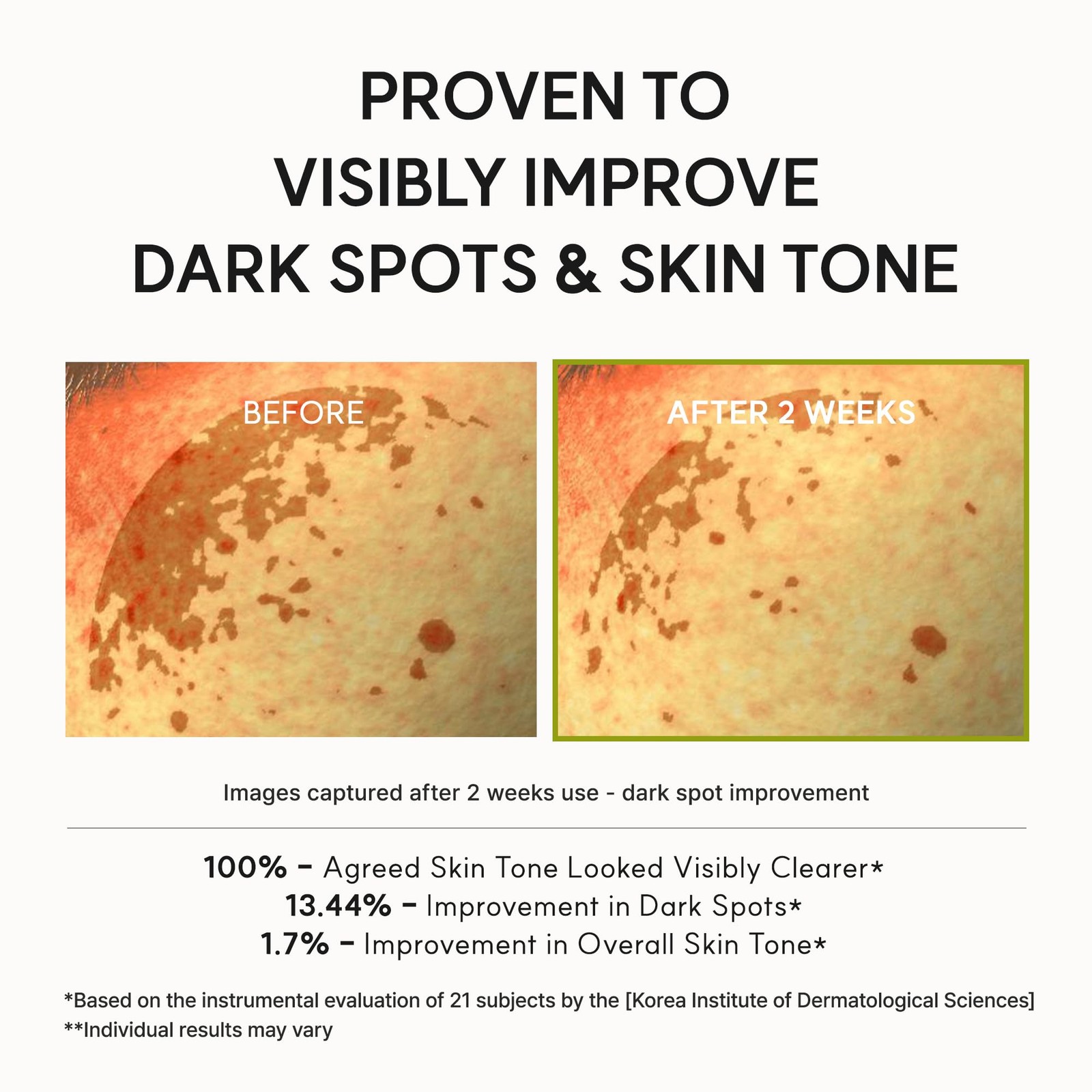 Vitamin C Booster Shot Serum with Glutathione, Niacinamide and Vitamin E for …