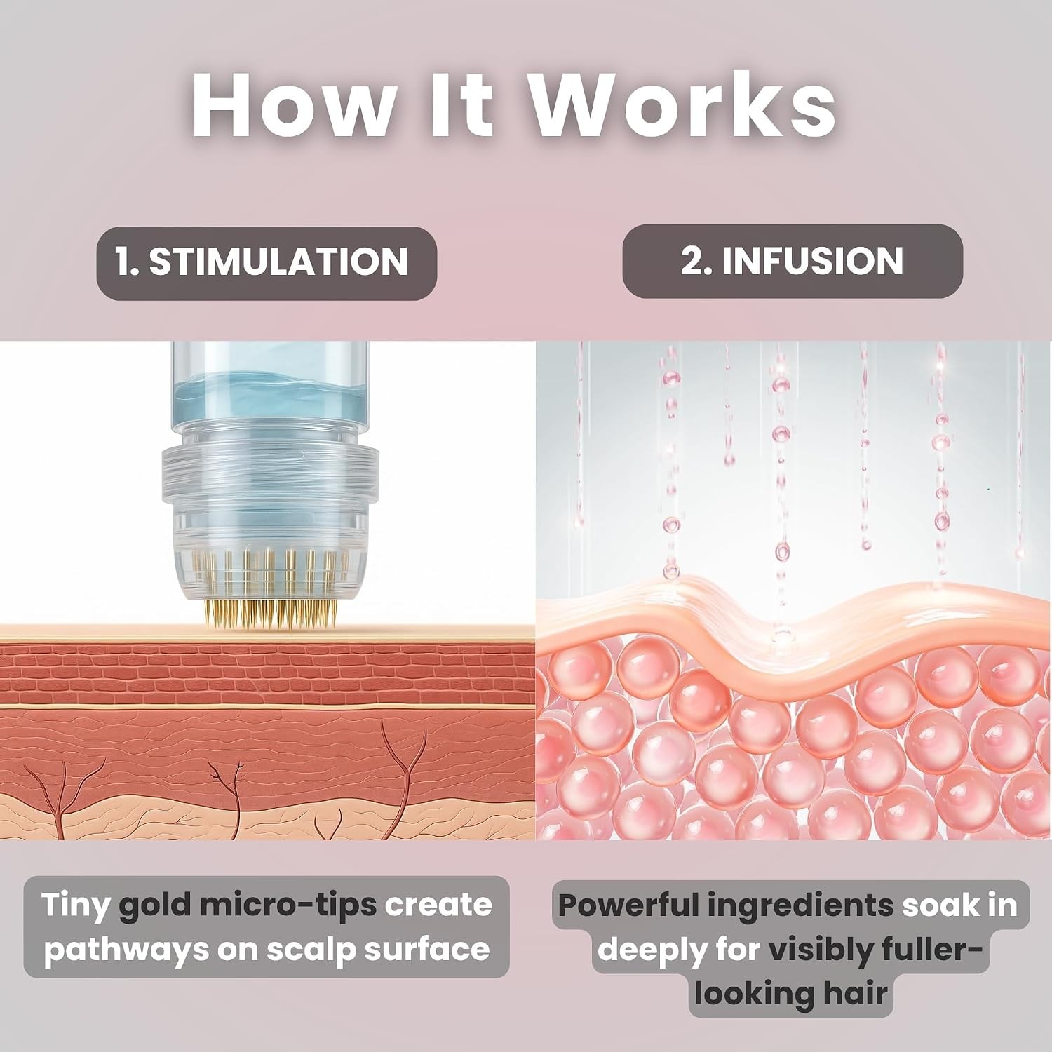 Beauty Micro Infusion Hair Renewal Kit – 0.25mm Gold Derma Stamp with Hyalu