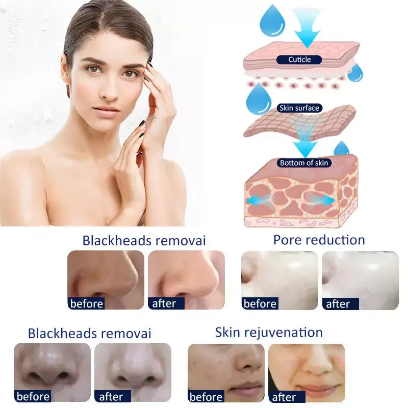 14In1 Facial Water Aqua Dermabrasion Machine Diamond Hydro Oxygen Jet Peeling