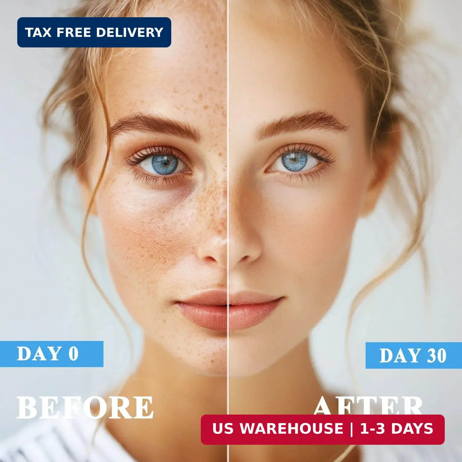 VBBV Dark Spot Remover for Face and Body, Dark Spot Corrector, Sun Spot Freckles