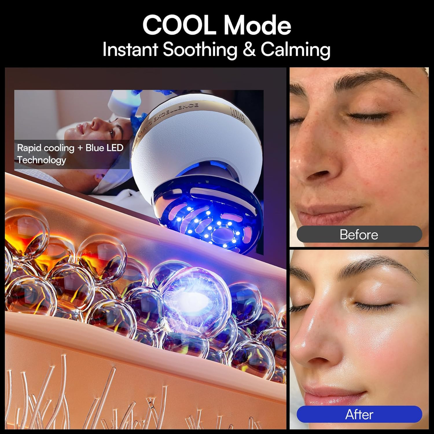 SPHERA Upgraded 8-In-1 Microcurrent Facial Device for Face & Neck – Red Light, T