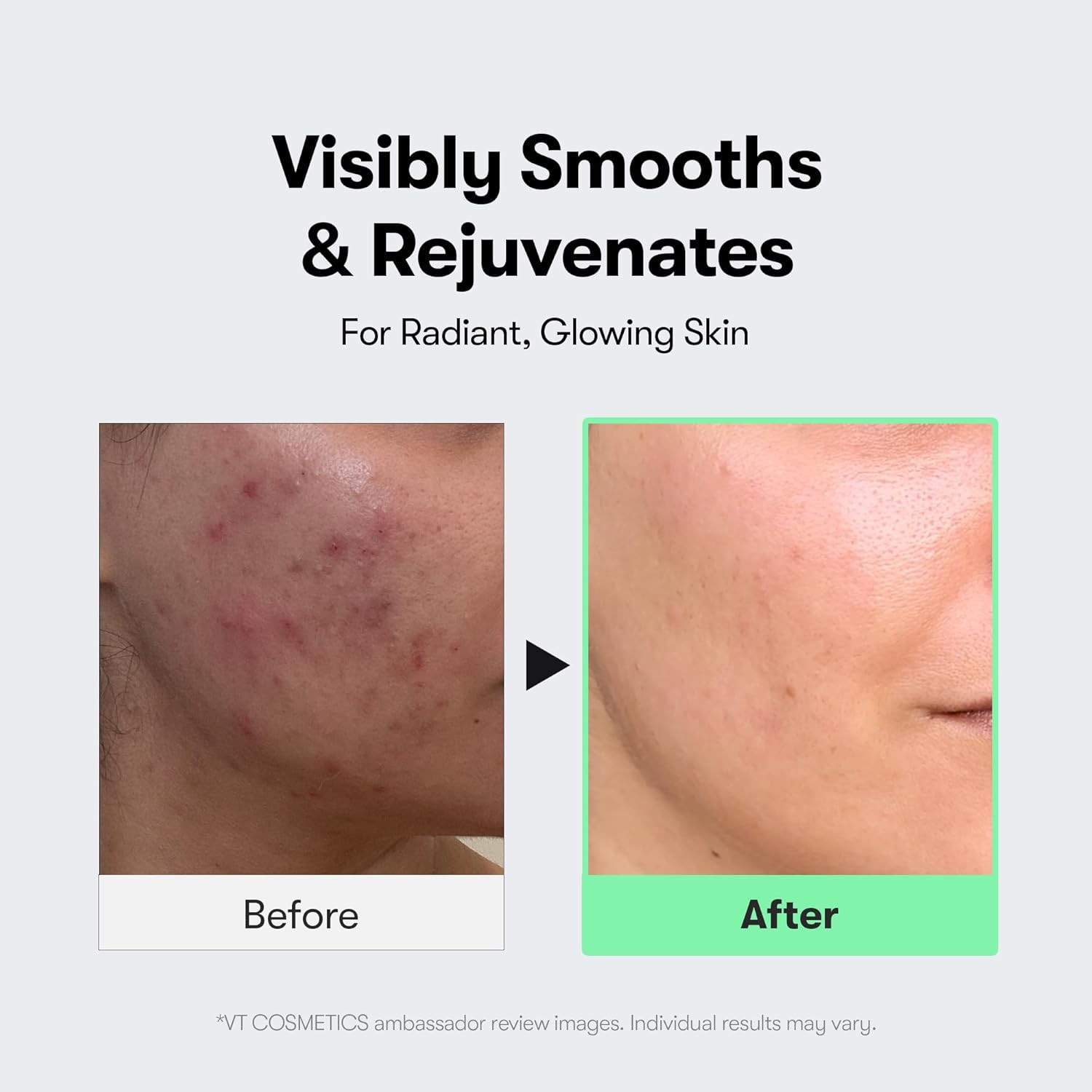 CICA Reedle Shot 300, Advanced Night Exosome, Microneedling Serum, Centella Asia