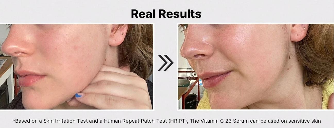COSRX Vitamin C23 Serum 20g – 23% Pure Vitamin C – Brightening, Wrinkle Care