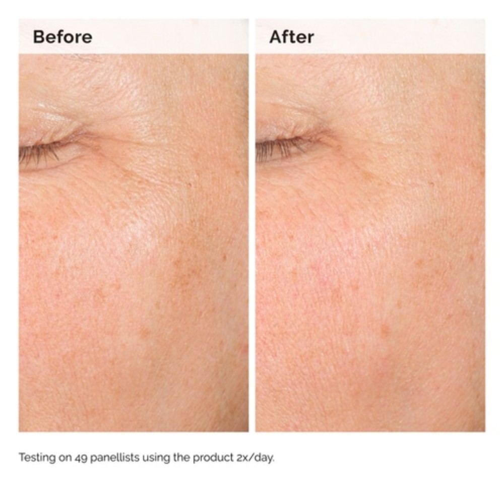 The Ordinary Authentic Alpha Arbutin 2% + Hyaluronic Acid Standard Or Value
