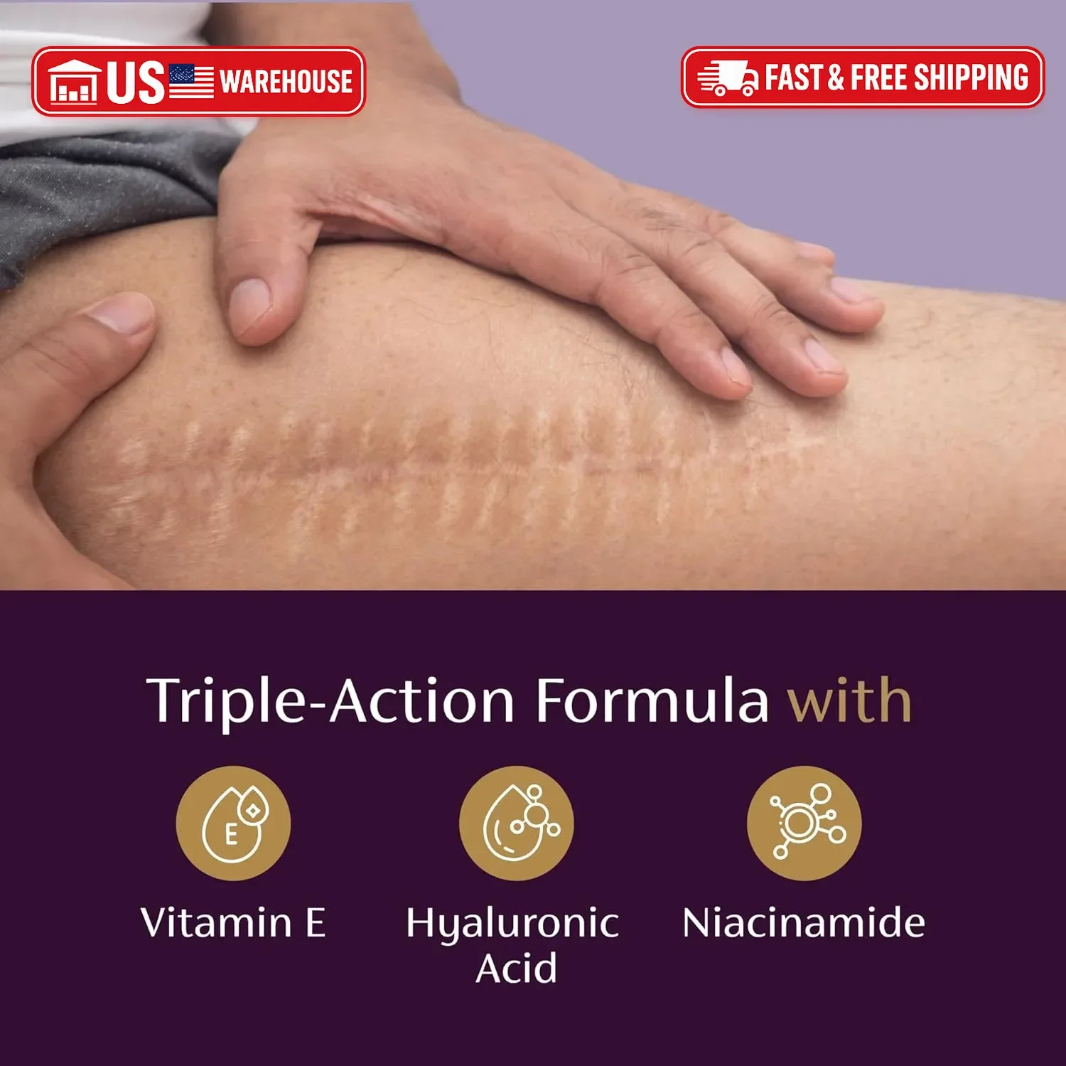 Mederma Scar Serum – Triple-Action Formula with Vitamin E, Hyaluronic Acid & Nia