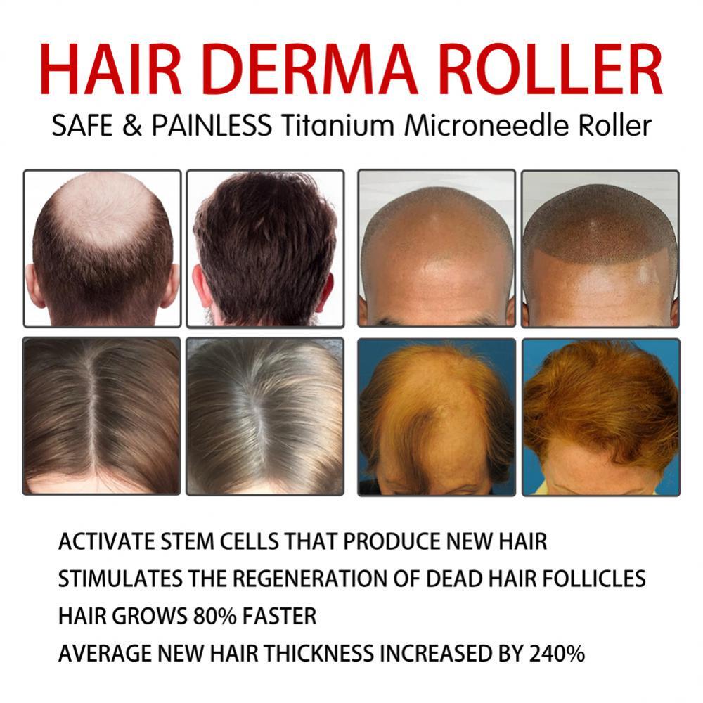 Beard and Hair Growth Derma Roller 0.5mm Titanium Derma Roller USA Fast Shipping