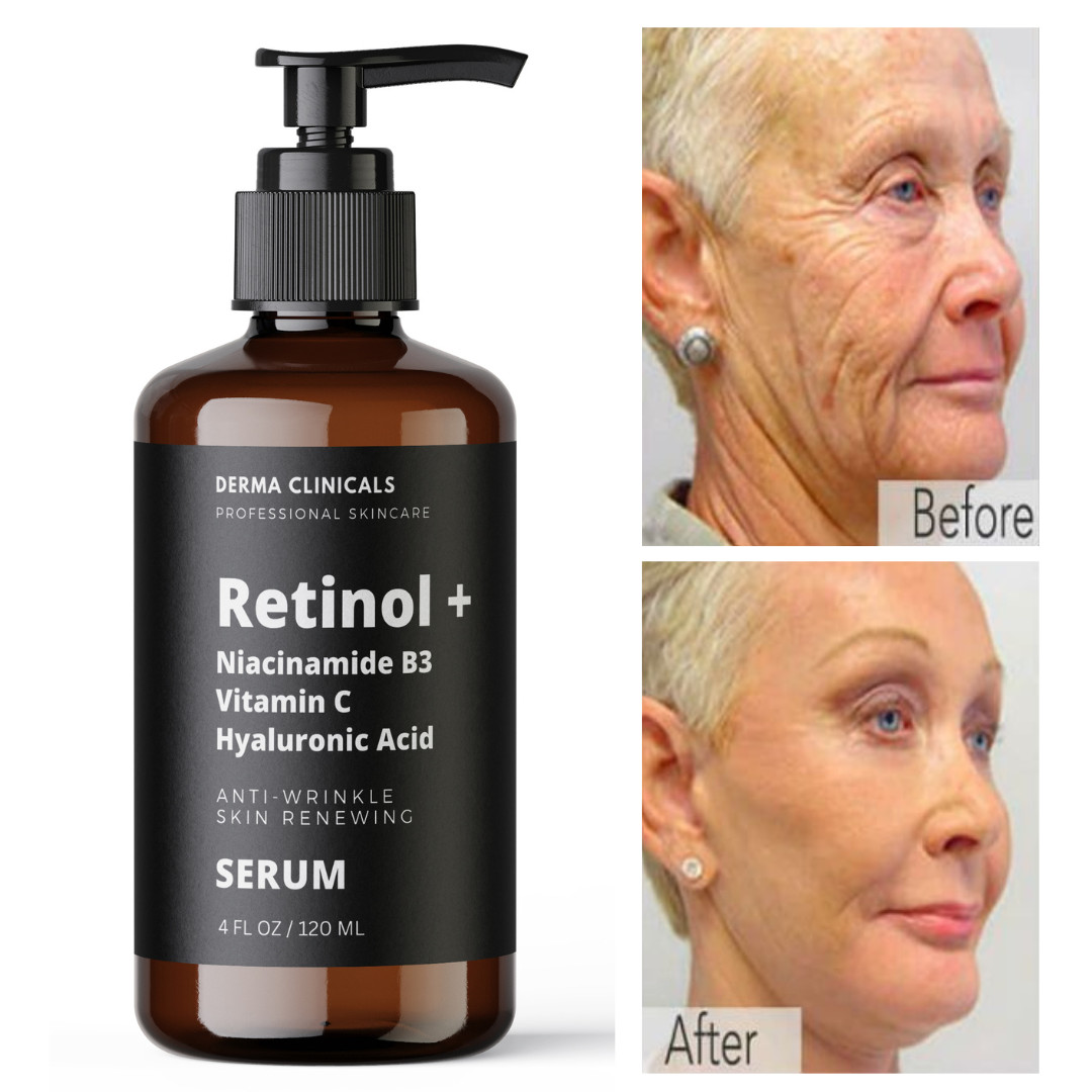 Retinol, Niacinamide, Vitamin C, Hyaluronic Acid, AntiAging Wrinkle SERUM – 4oz
