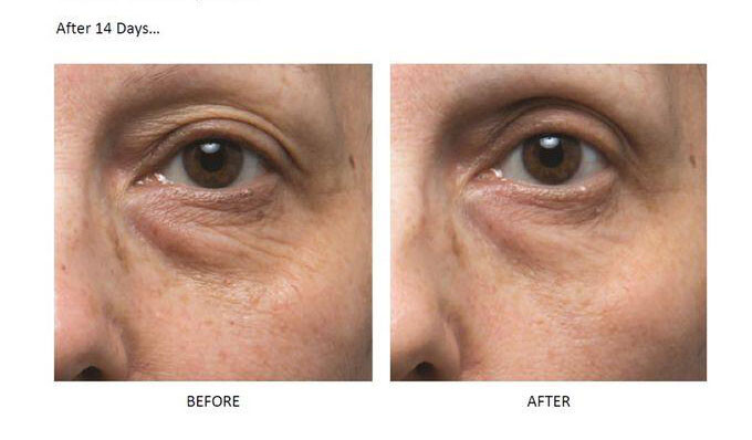Triple-Peptide EYE SERUM w/ Hyaluronic Acid, Vitamin C – Bags-Dark Circles Cream