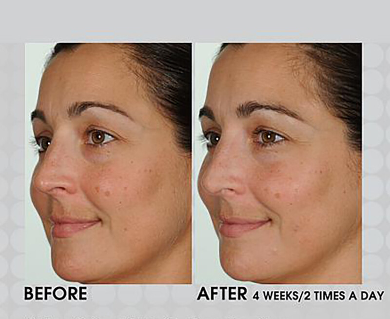 Anti-Aging Retinol Vitamin A 2.5% TURN BACK THE CLOCK Facial Face Serum Cream